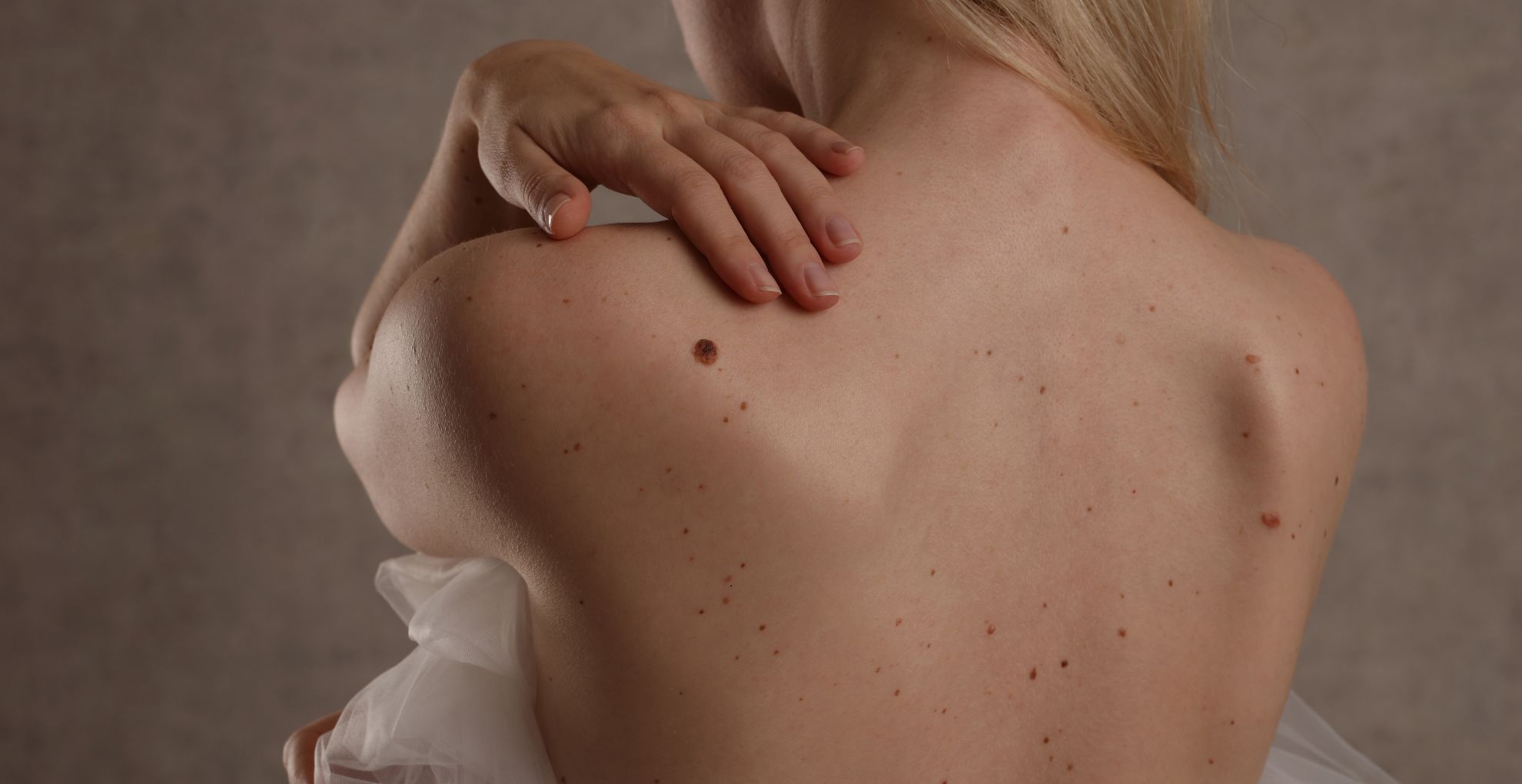 Preventive Measures for Skin Cancer You Should Know