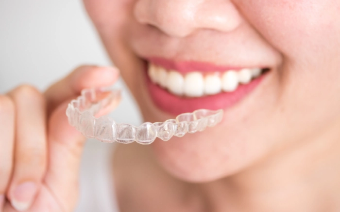 Understanding the Benefits of Clear Aligners for Adults