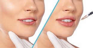 What To Expect From Botox Applications