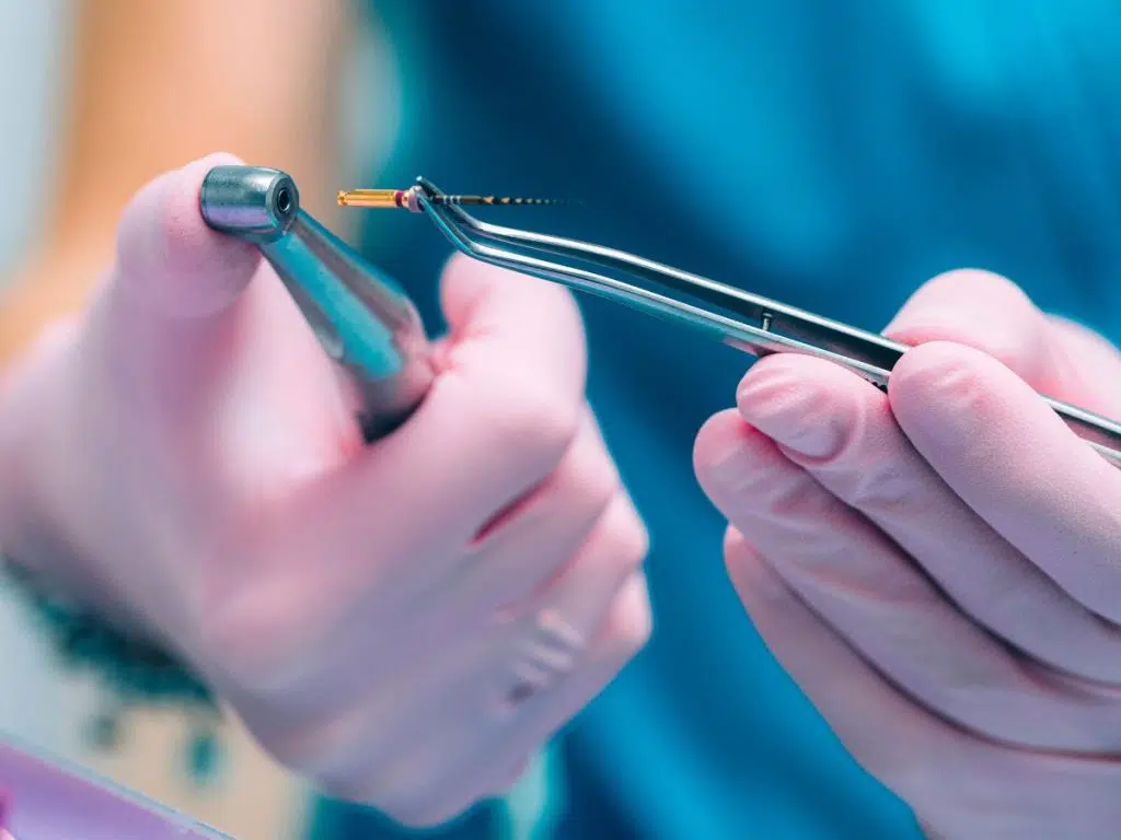 Benefits of Seeing an Endodontist for Tooth Pain