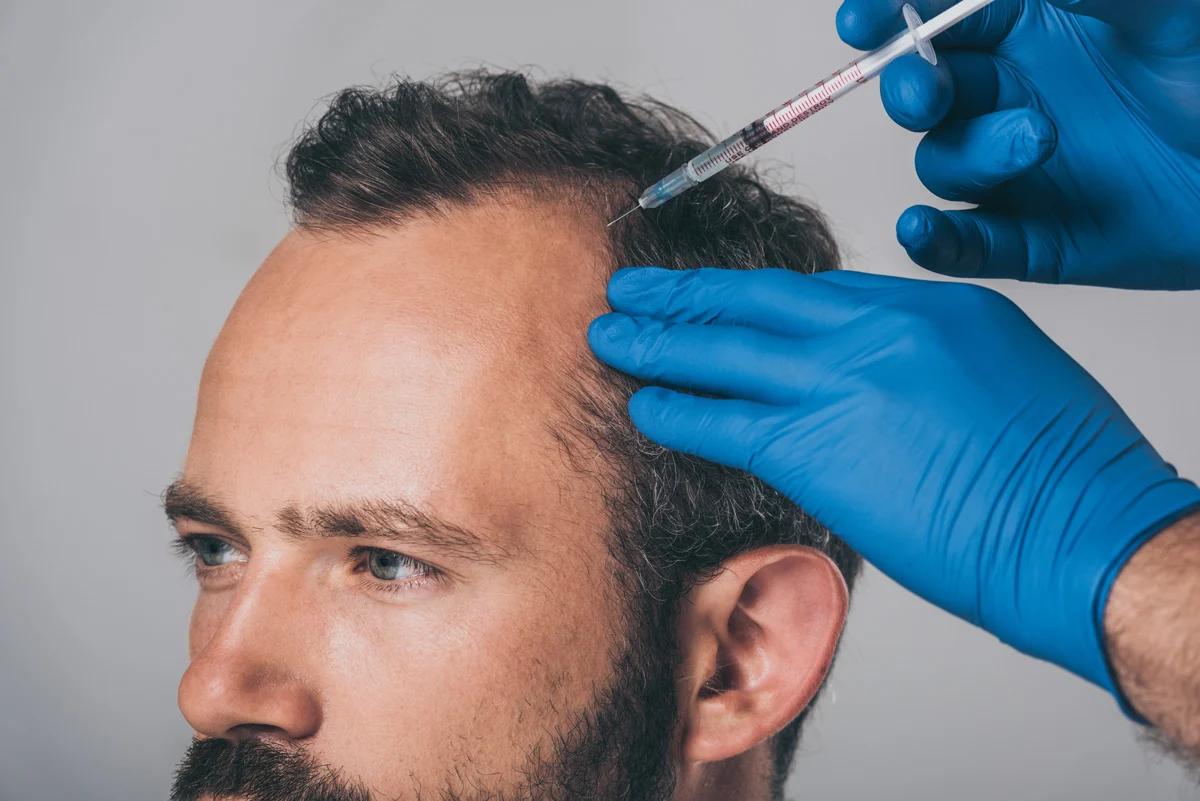 Innovations in Hair Restoration Technology