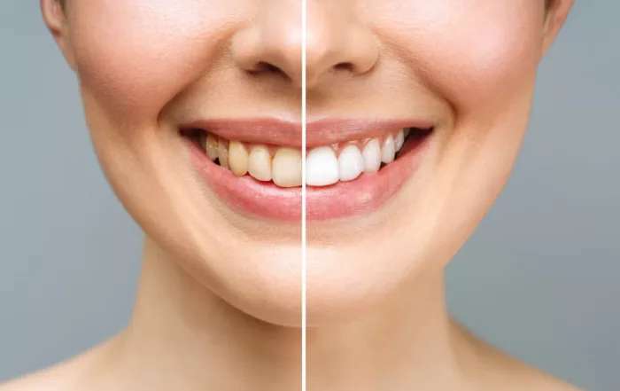 Understanding the Different Areas of Cosmetic Dentistry