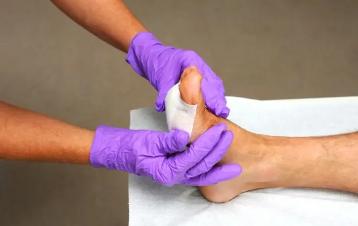 Exploring the Connection Between Diabetes and Wound Healing