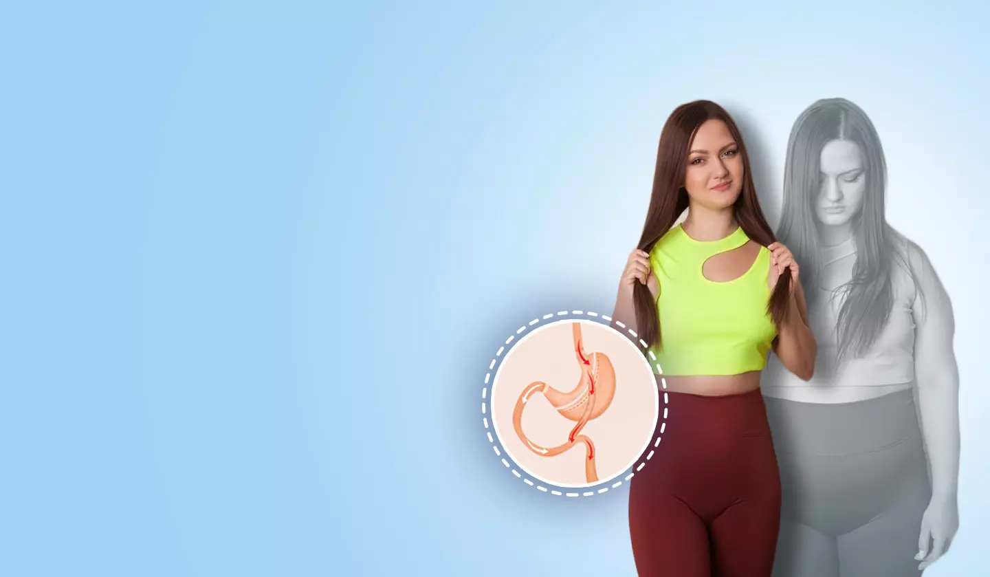 Exploring the Different Approaches to Bariatric Surgery