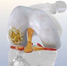 Preparing for a Successful Outcome After a Cartilage Injury