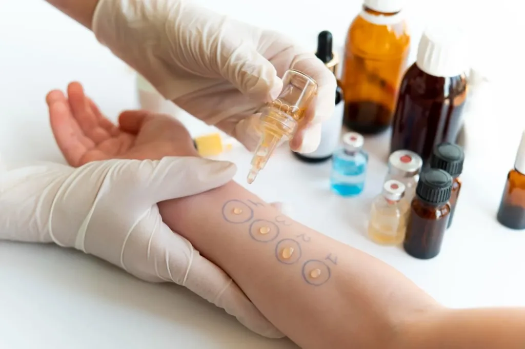 The Process and Benefits of Allergy Testing for Seasonal Allergies