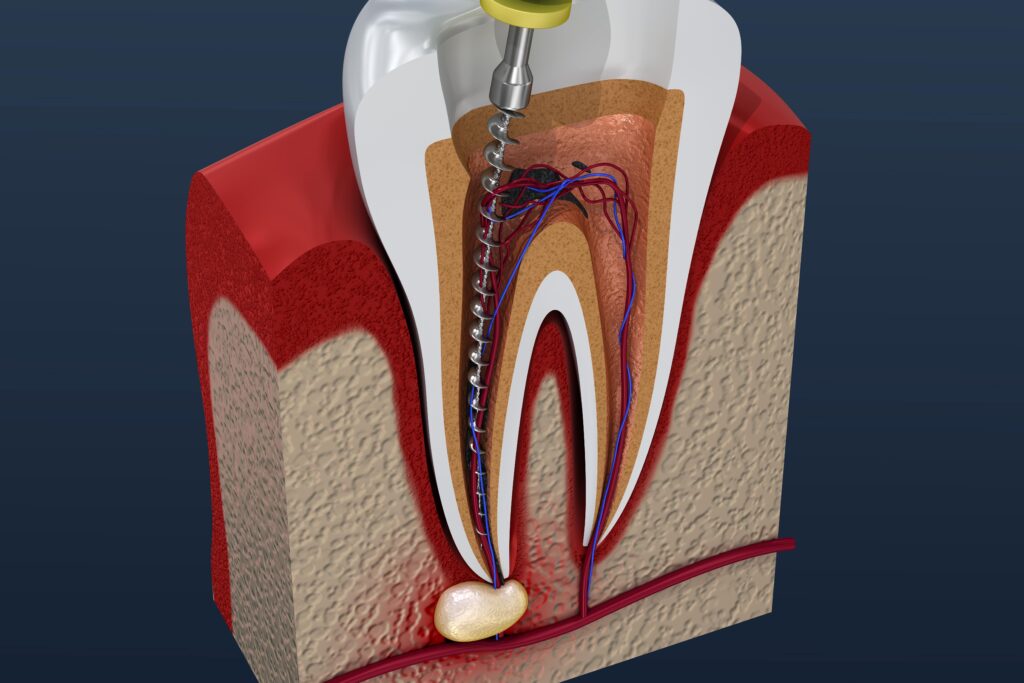The Role of an Endodontic Specialist in Dental Care The Role of an Endodontic Specialist in Dental Care