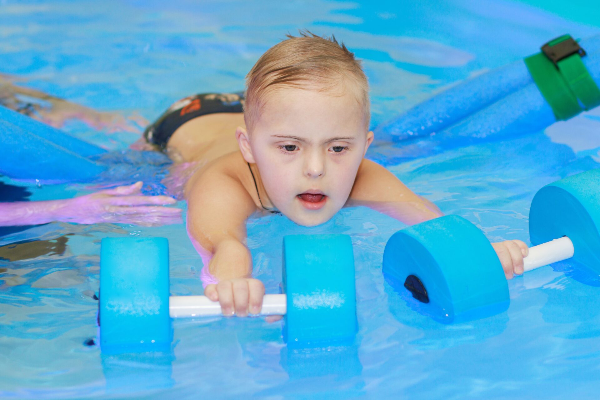 Therapies and Treatments for Cerebral Palsy