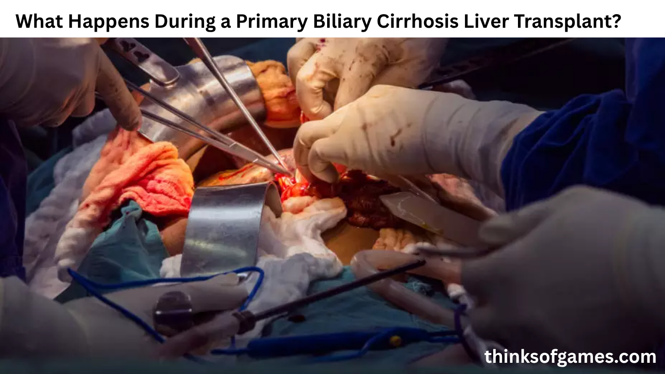 What Happens During a Primary Biliary Cirrhosis Liver Transplant?