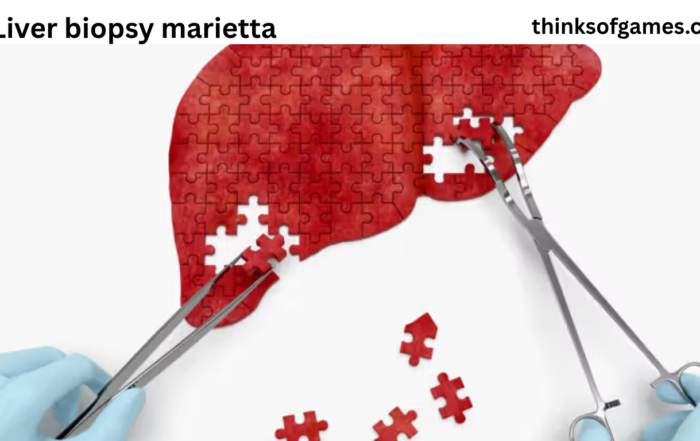 liver biopsy marietta