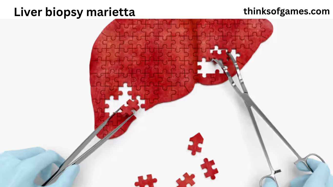 liver biopsy marietta