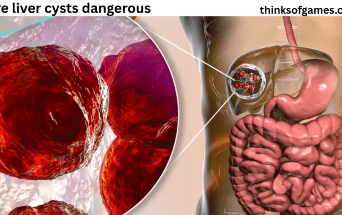 are liver cysts dangerous